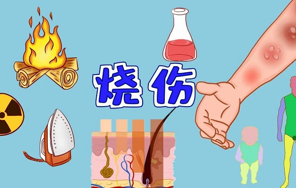 夢(mèng)見(jiàn)燒傷 做夢(mèng)夢(mèng)見(jiàn)燒傷是什么預(yù)兆 夢(mèng)見(jiàn)燒傷好不好